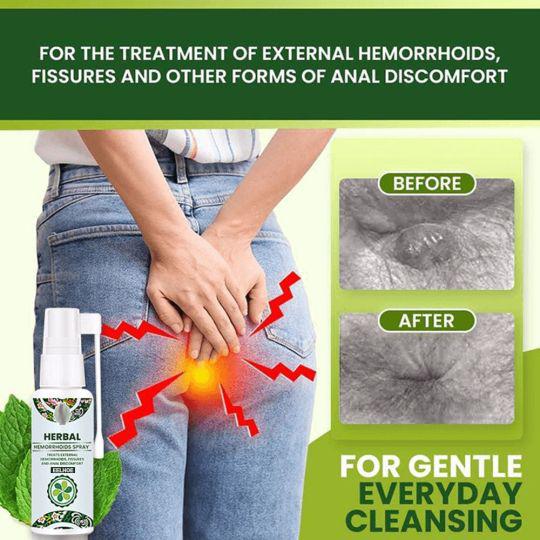 Natural Hemorrhoids SPRAY